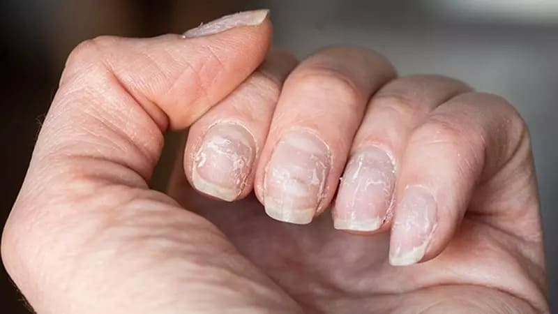 nagelpflege-um-trockenheit-im-sommer-zu-vermeiden-1